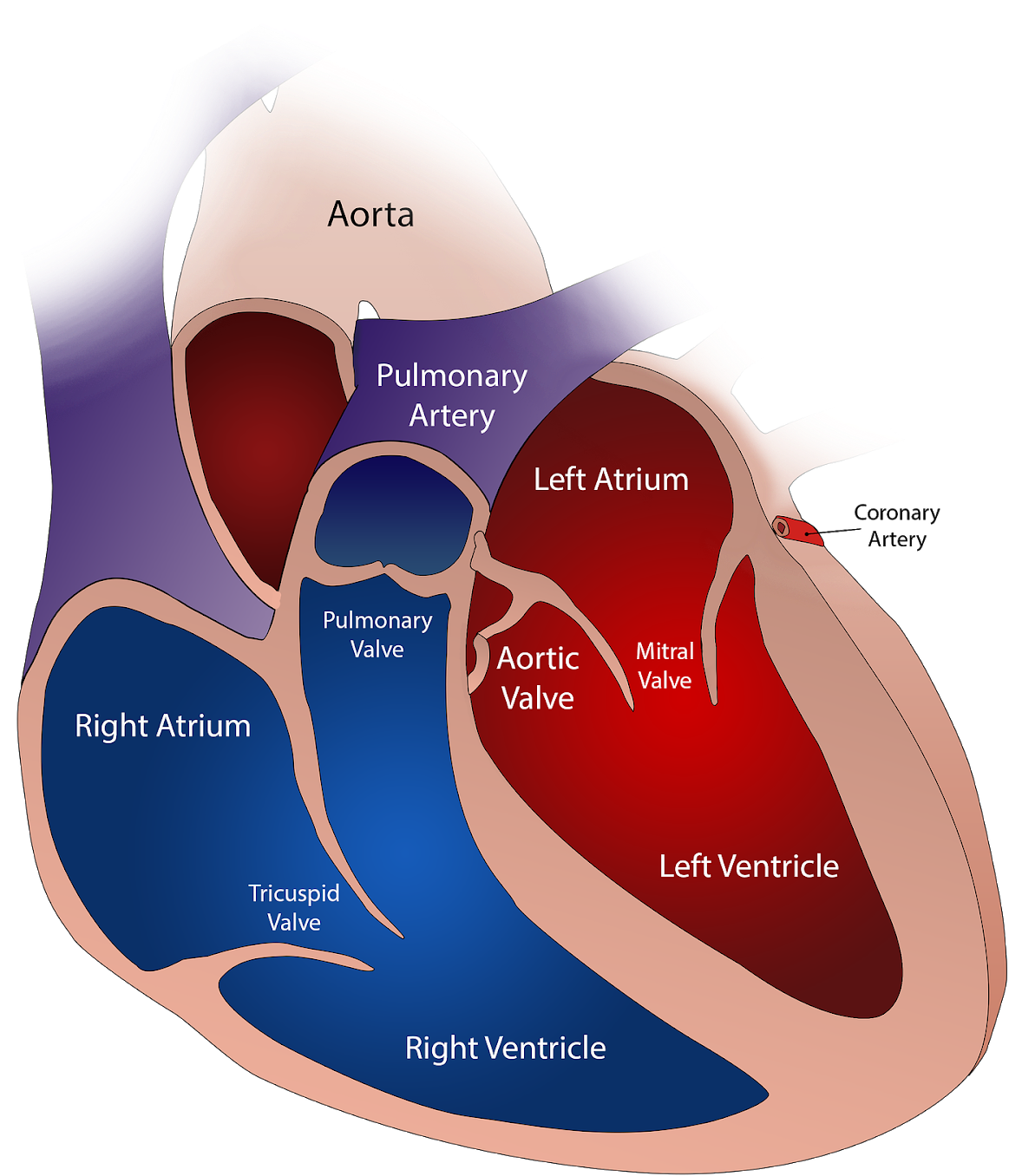The Human Heart Has Four Valves - Severely Dilated Left Atrium (1080x1280), Png Download