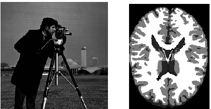 Original Images 'cameraman' And Phantom Of A Brain - Monochrome (514x264), Png Download