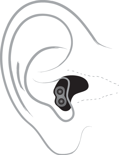 Ear Clipart Audiology - Hearing Aid (481x626), Png Download