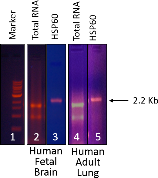 Human Fetal Brain And Human Adult Lung (lines 4, 5) - Colorfulness (591x648), Png Download