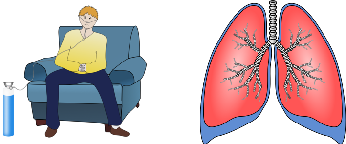 Cough Clipart Lung Disease - Chronic Respiratory Disease Clipart (848x296), Png Download