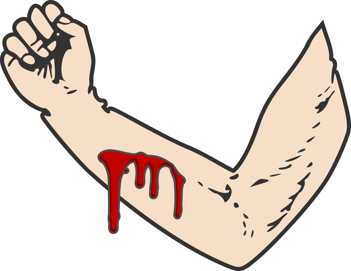 Bloody-arm - Arm (1203x929), Png Download