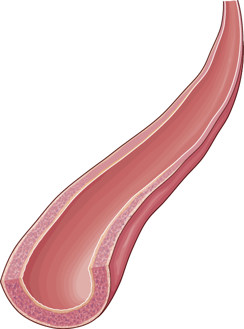 Arteries - Plywood (477x642), Png Download