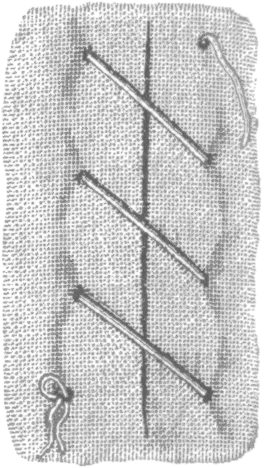 Types Of Stitches Used In Sutures, From Dictionnaire - Types Of Sutures (418x694), Png Download