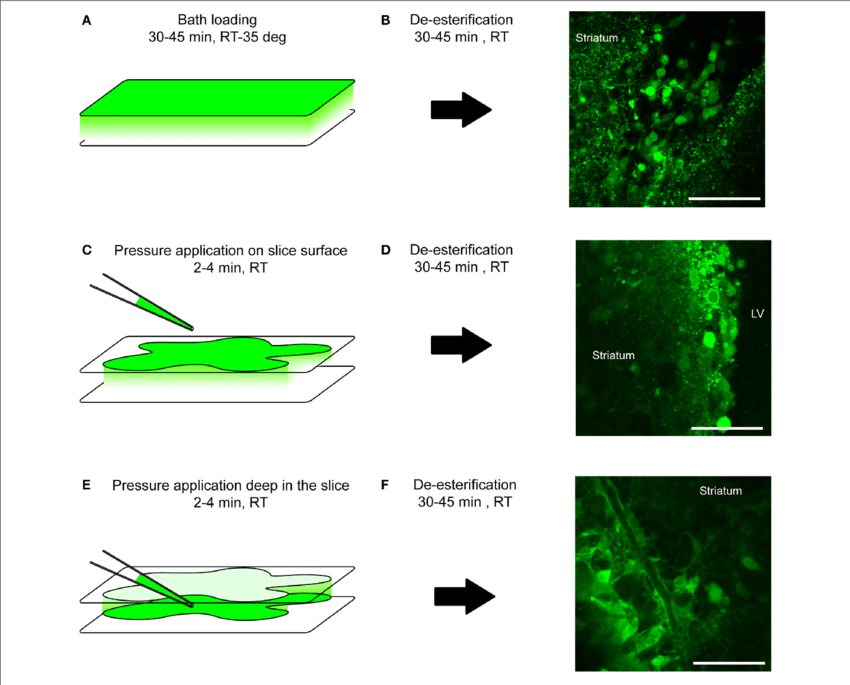Loading Protocol Of Calcium Indicator Dyes - Brain Slice Calcium Imaging (850x685), Png Download