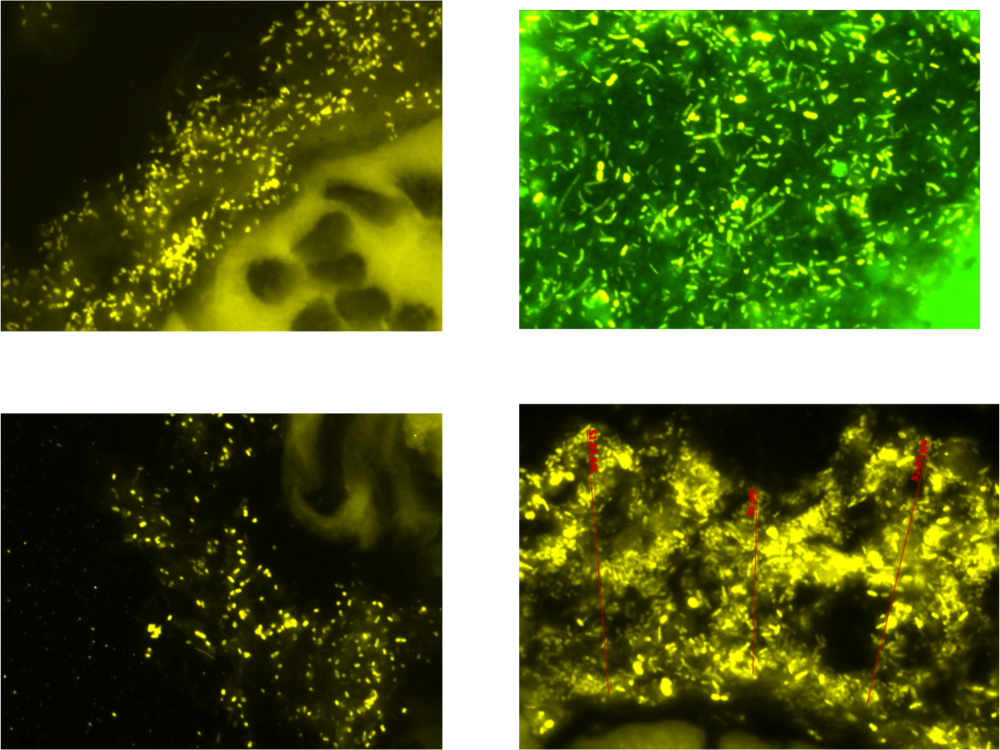 Bacteria (1000x750), Png Download