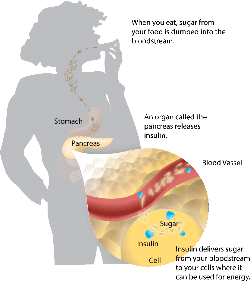 Diabetes Genetics (976x1027), Png Download