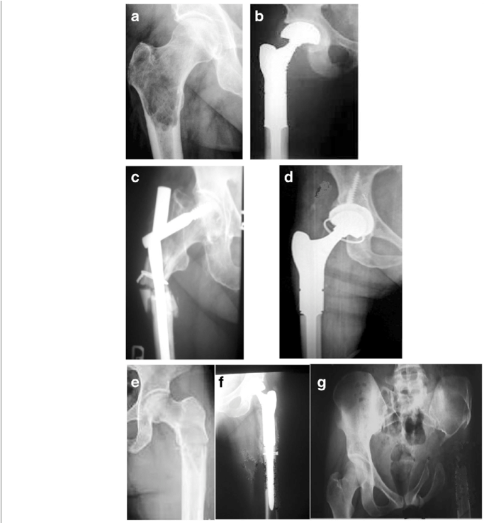 Preoperative And Postoperative Radiograms Series - Radiography (850x738), Png Download