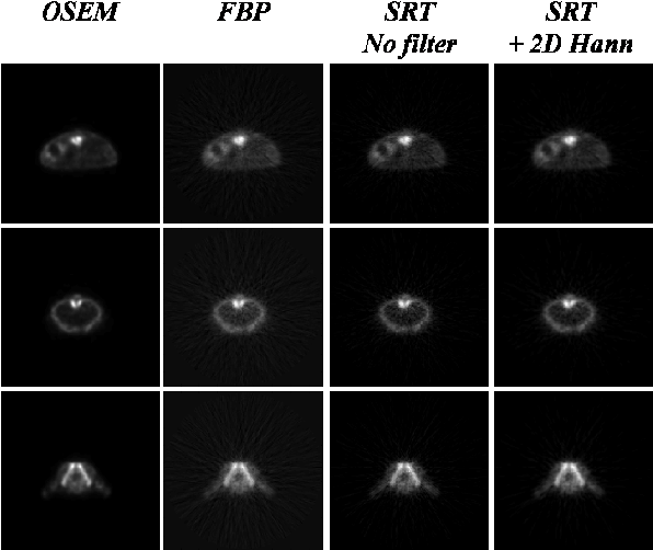 Three Different Slices Of An Fdg Mouse Scan Acquired - Moon (597x516), Png Download