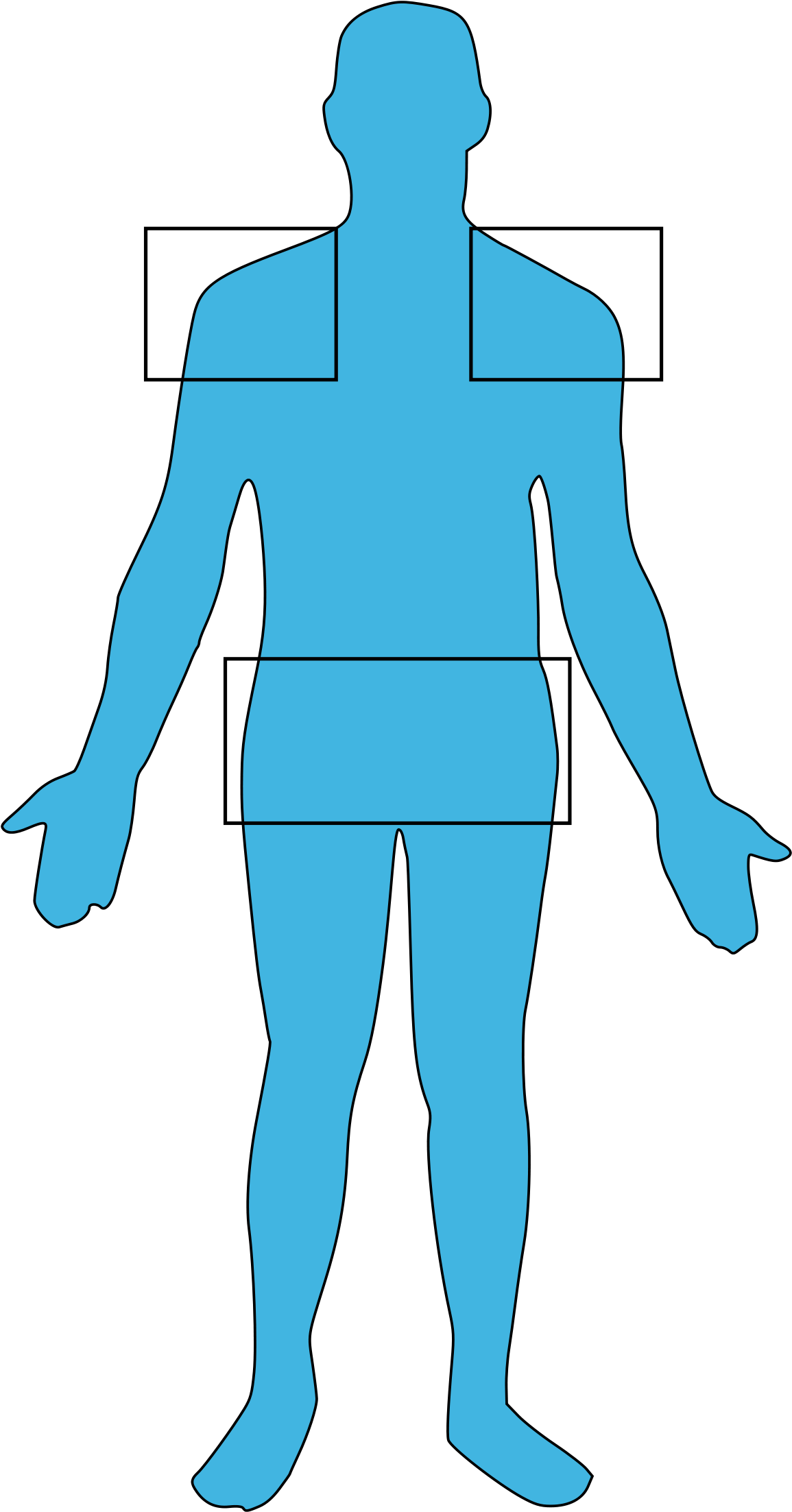 Polymyalgia Rheumatica (1200x2276), Png Download