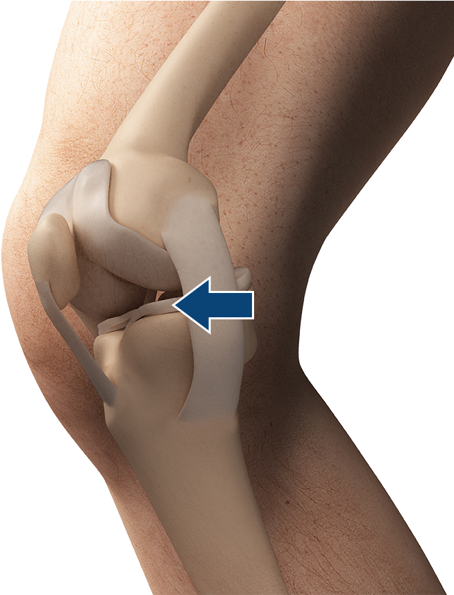 Meniscus - Ligaments Png (698x856), Png Download