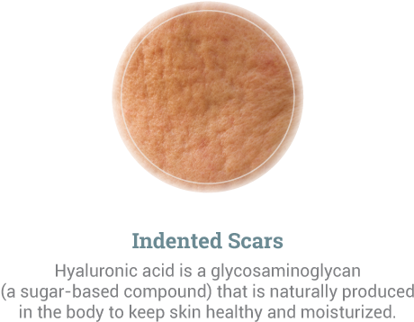Cosmetic Scar Treatment - Eye Shadow (500x400), Png Download
