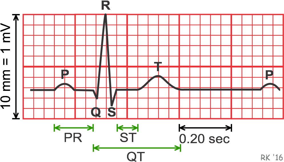 Electrocardiogram Durations And Intervals - Electrocardiography (1012x585), Png Download