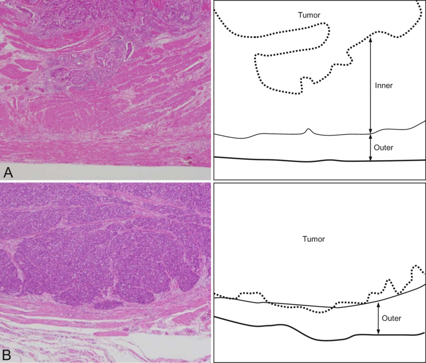 In The Schemas On The Right, The Dotted Lines Show - Drawing (850x725), Png Download