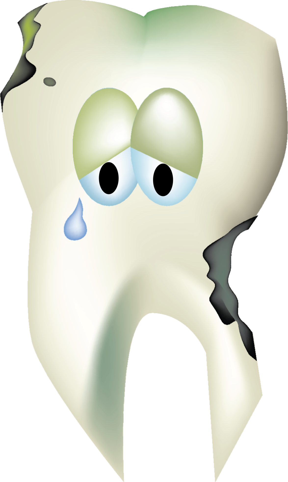 Tooth Clipart Png Vector Freeuse Stock - Clip Art Of Tooth Decay (1174x1964), Png Download