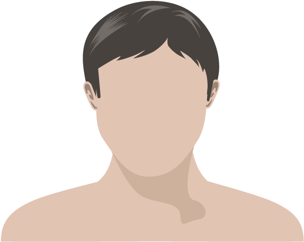 Chemically Treated Hair - Human (607x500), Png Download