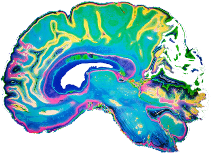 Brain Scan Transparent (500x313), Png Download