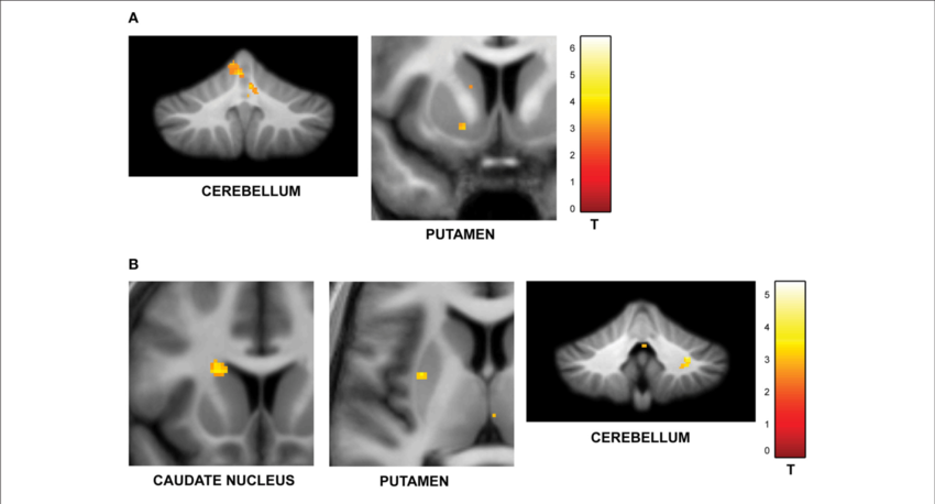 Download - Functional Imaging (850x458), Png Download