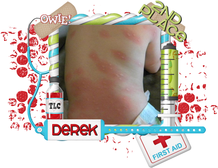 Ouchcontest1st Ouchcontest2nd (720x557), Png Download