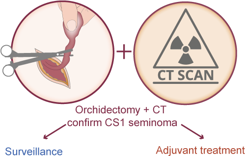 Management Of Clinical Stage 1 Seminoma With Surveillance - Circle (600x380), Png Download