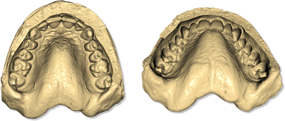 File - Maestro3d - Easy - Dental - Scan - Taget - Object (925x399), Png Download