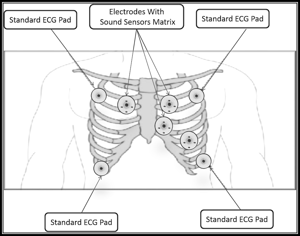 Cardiovascular Disease Is The Leading Cause Of Death - Cartoon (1000x785), Png Download