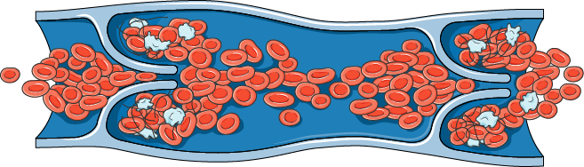 Vein - Vein Clip Art Png (657x188), Png Download