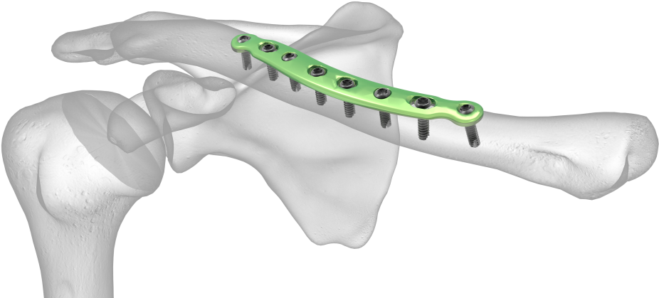 See All Images (1024x576), Png Download