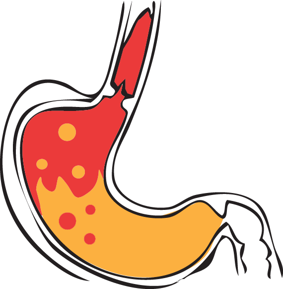 Stomach Acid Transparent - Stomach Acid Png (570x581), Png Download
