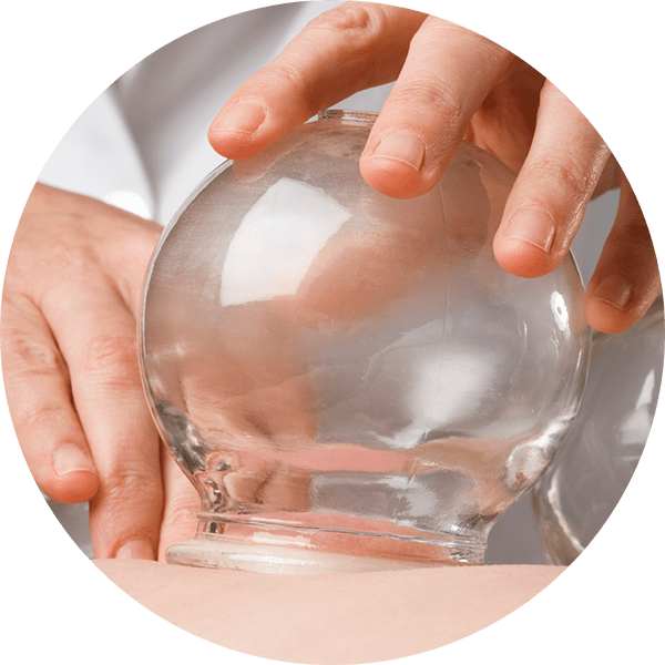 Cupping - Cupping Therapy (600x600), Png Download