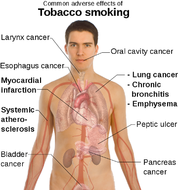 Smoking Effects On The Human Body - Some Effects Of Smoking (369x388), Png Download