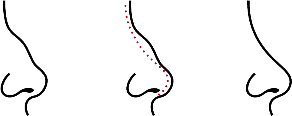 Care Must Be Taken For Several Weeks After Surgery (1056x441), Png Download