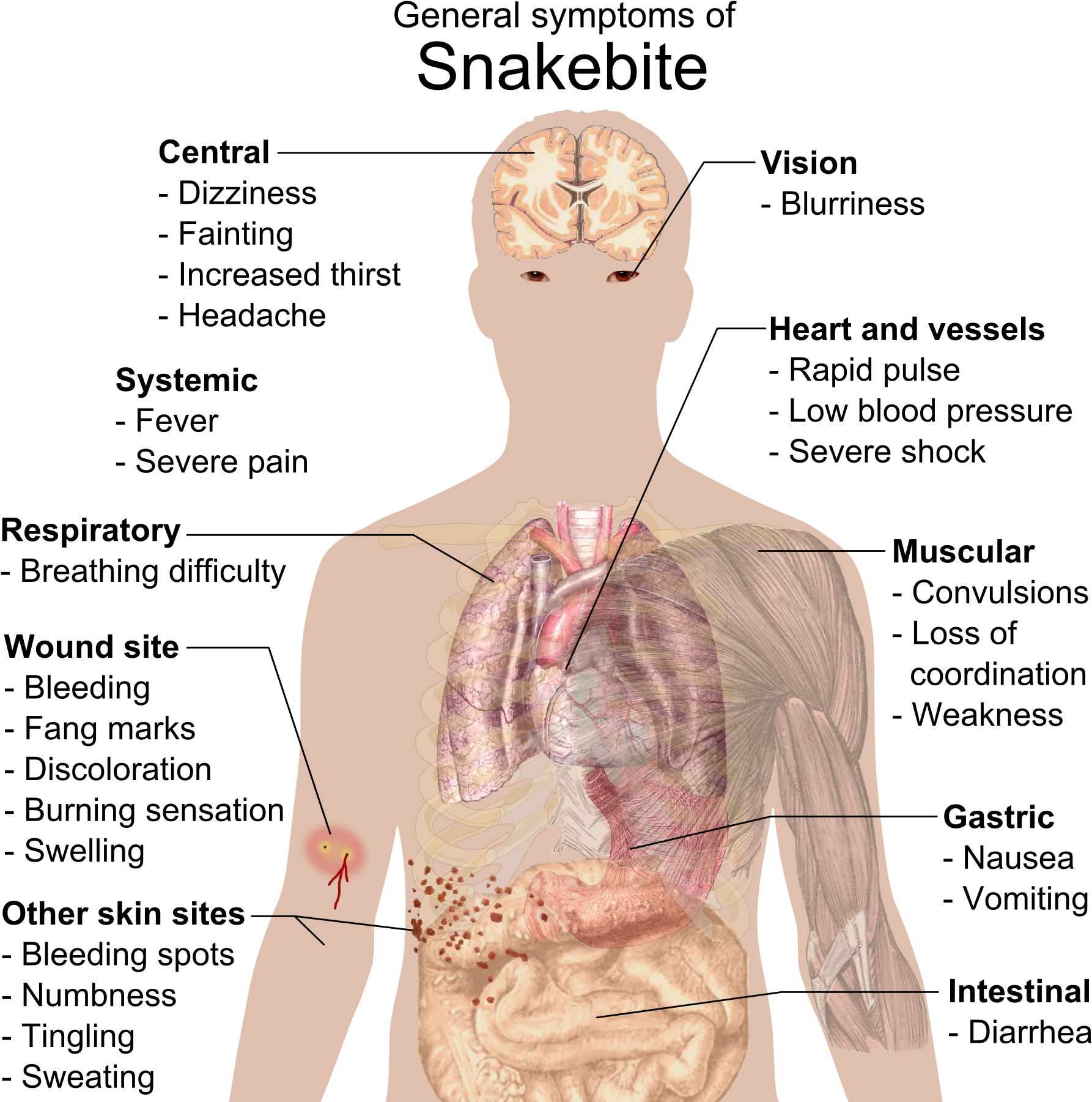 Signs And Symptoms - Do Drugs Affect The Body (1826x1817), Png Download