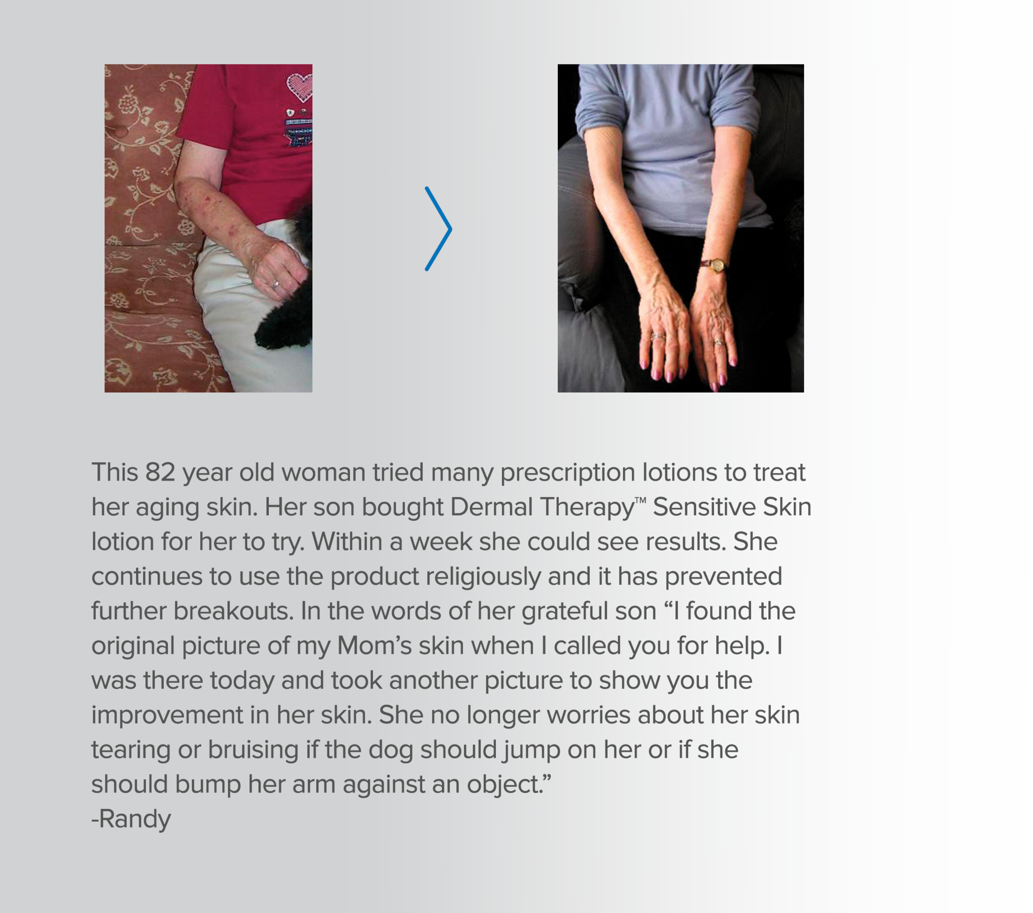 Dermal Therapy Sensitive Skin Care Soothes And Smooths - Brochure (2048x1811), Png Download