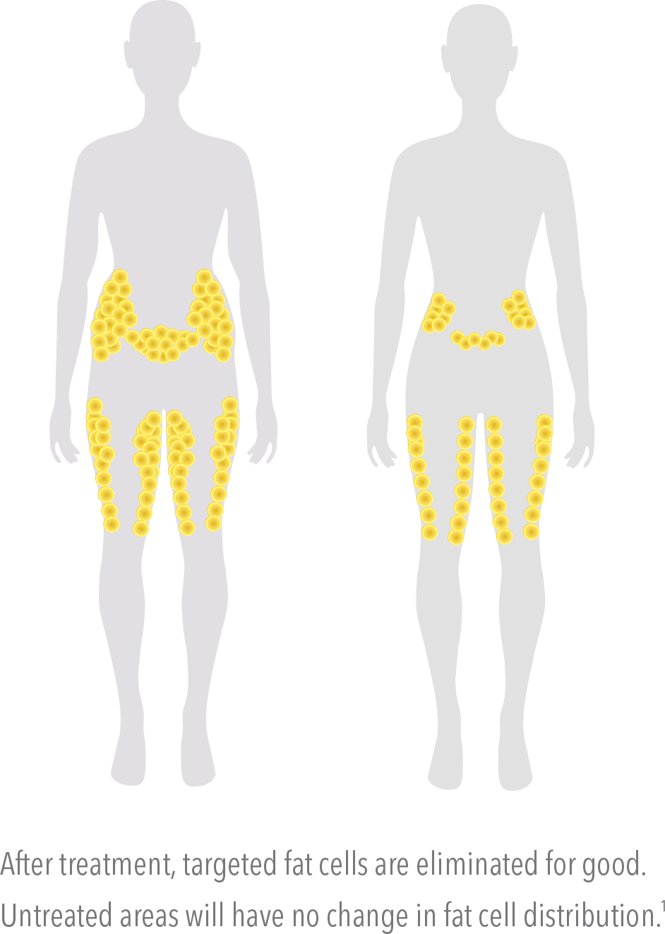 What - Standing (942x1323), Png Download