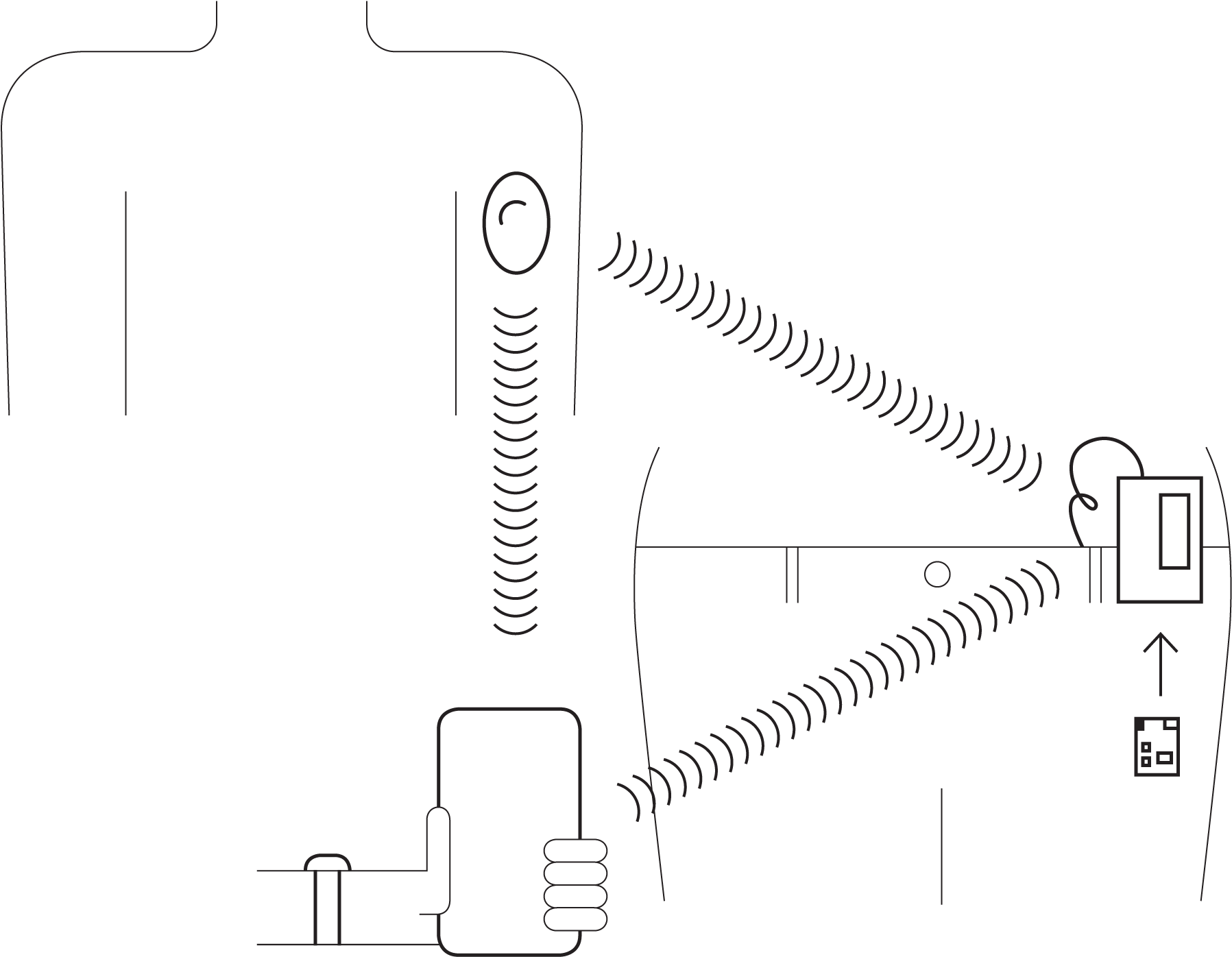① A Glucose Monitor Attached To A Person Uses A Bluetooth - Eli Lilly Automated Insulin Delivery System (2320x1514), Png Download