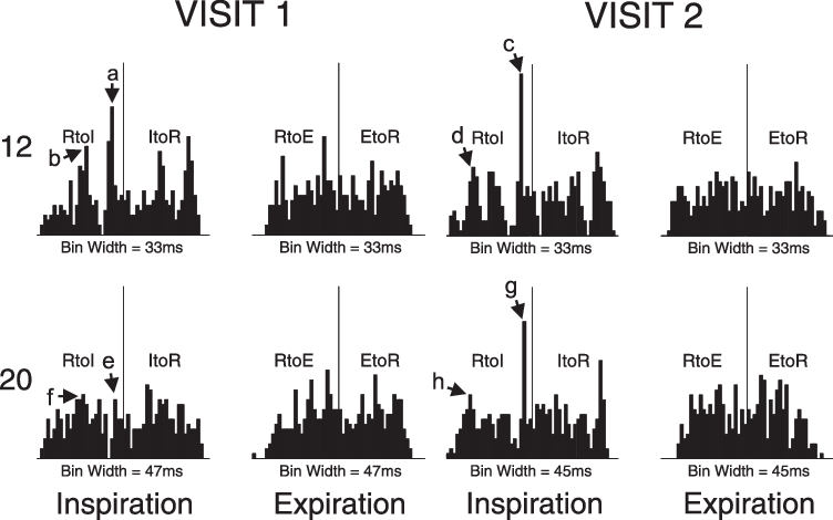 The 27-bin Interval Histograms For 2 Subjects - Metropolitan Area (752x470), Png Download