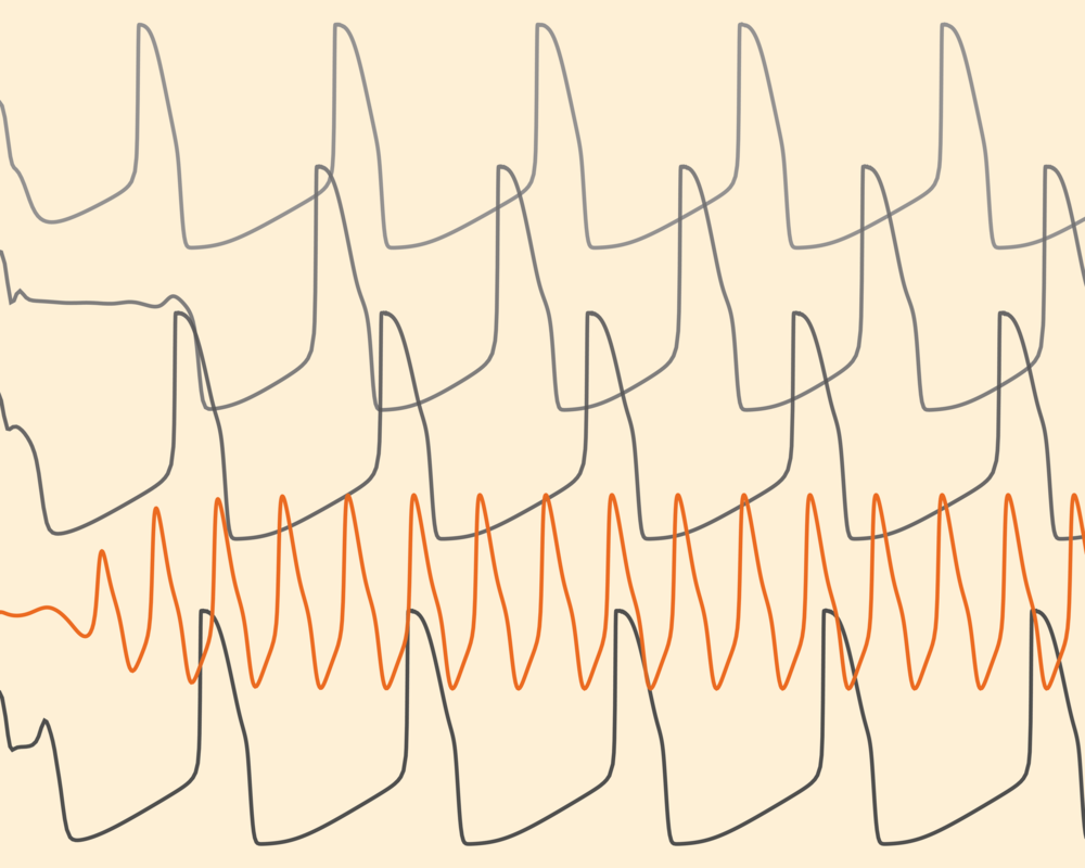 3artboard 1 (1000x800), Png Download