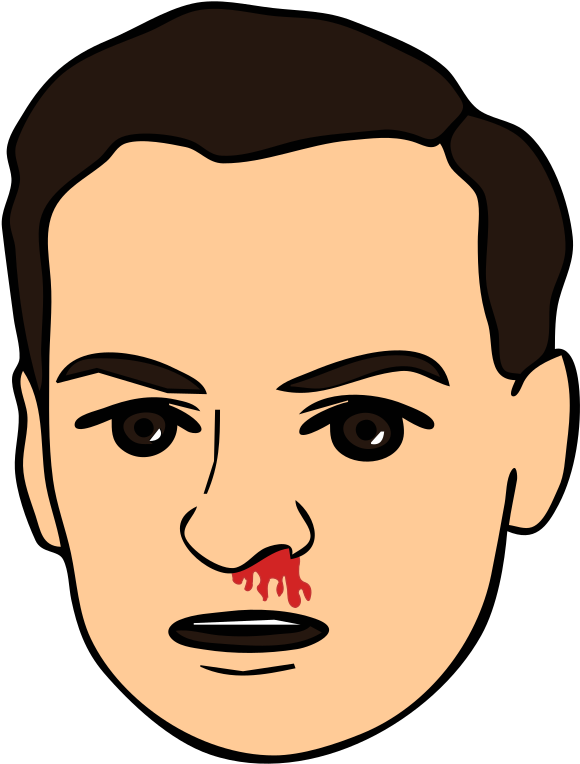 Bloody Nose - Drawing Face Of Man (640x800), Png Download