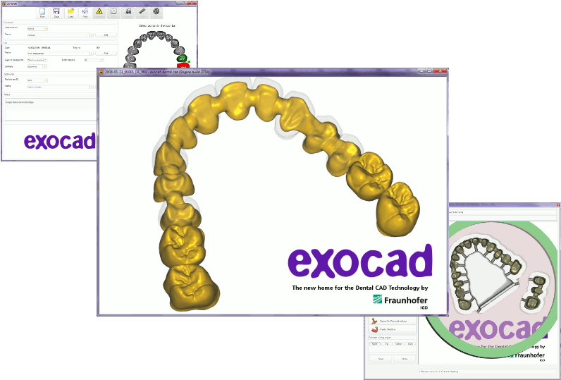 52, 29 August 2010 - Exocad (804x554), Png Download