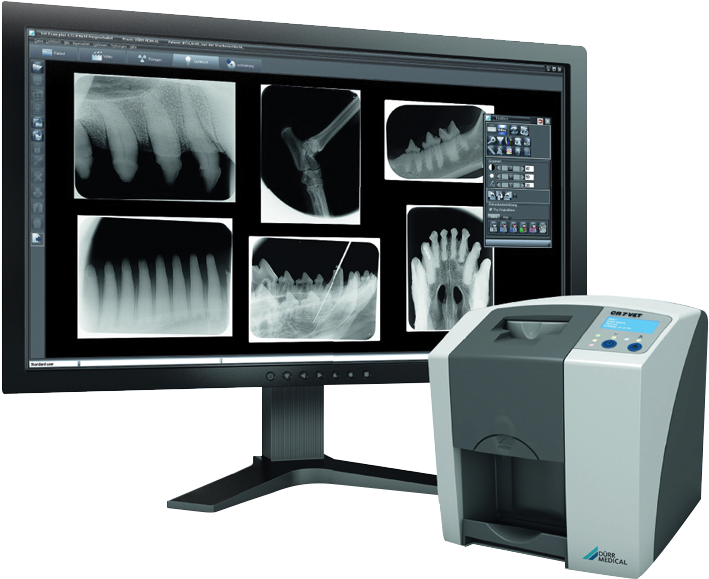 Im3 Cr7 Vet Dental Xray System - Cr7 Dental X Ray (772x706), Png Download
