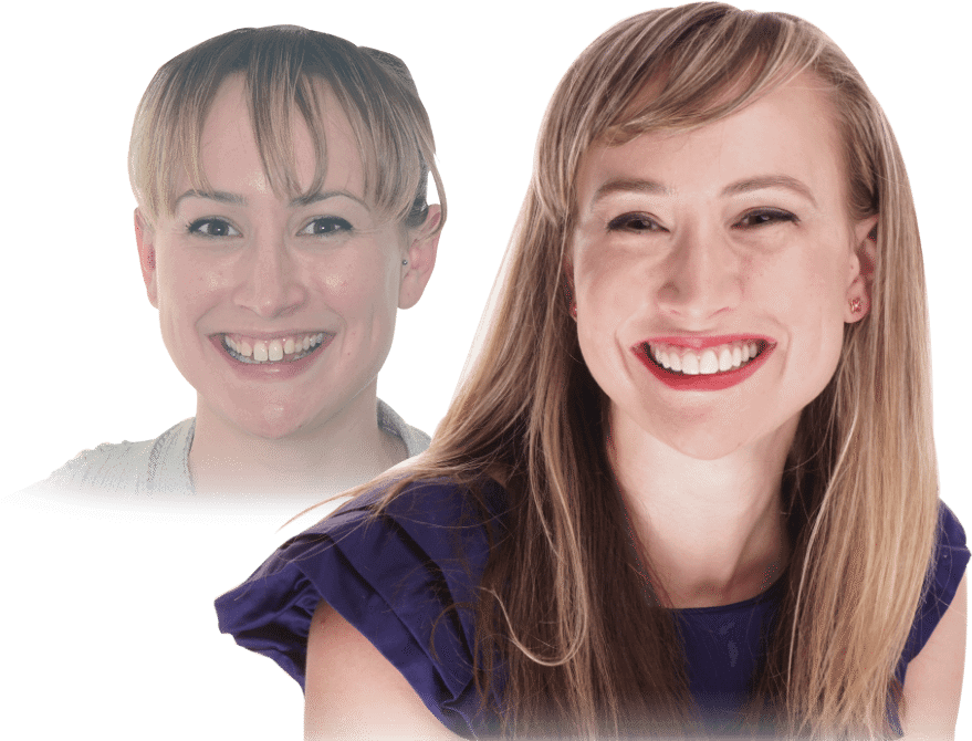 Before And After Dental Smile Gallery - Dental Boutique Before And After (934x691), Png Download