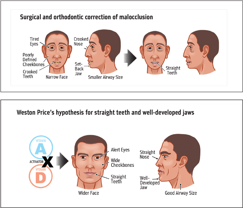 Orthotown Magazine (1000x855), Png Download