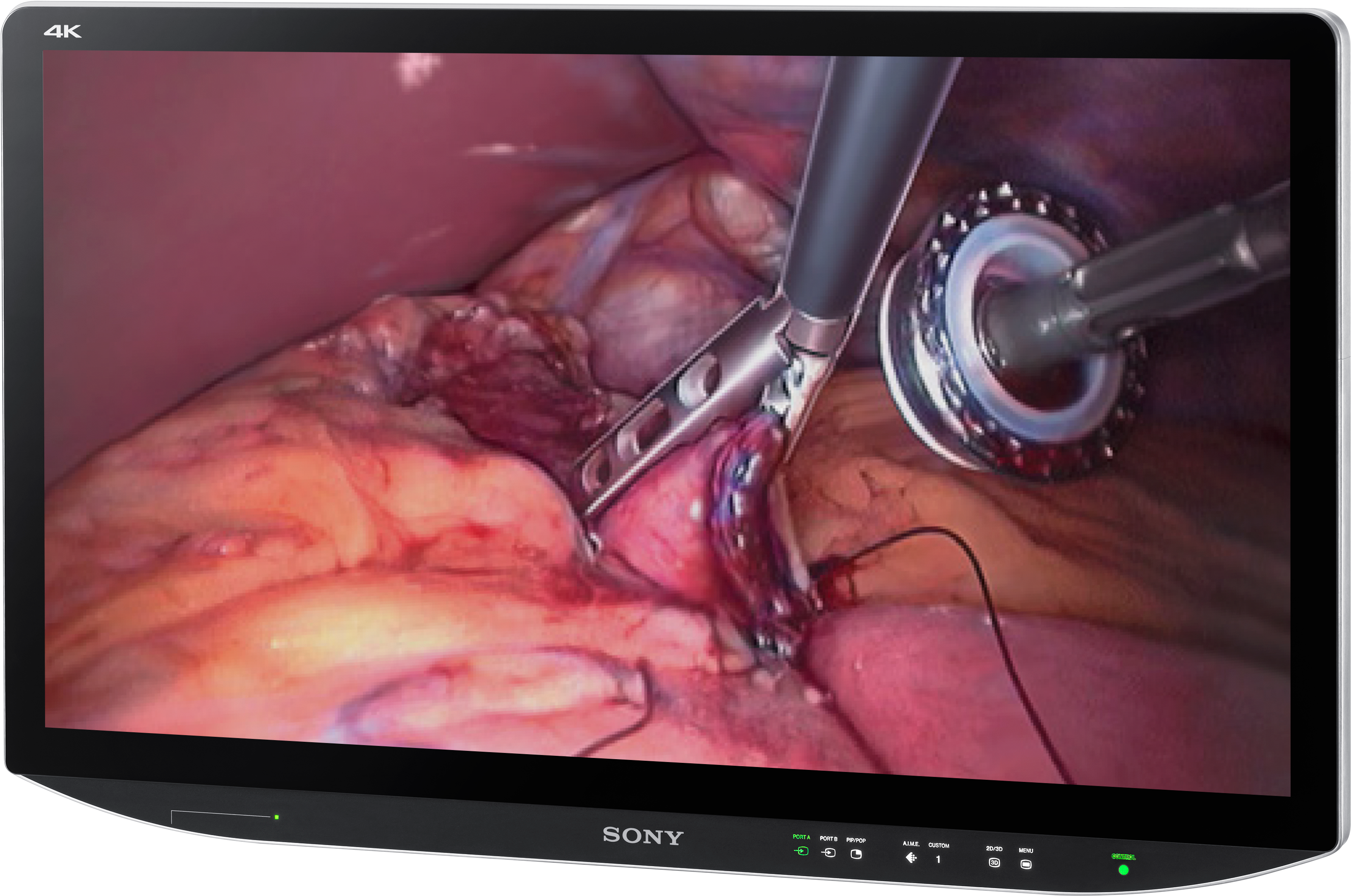 Sony Medical Monitors (3642x2734), Png Download