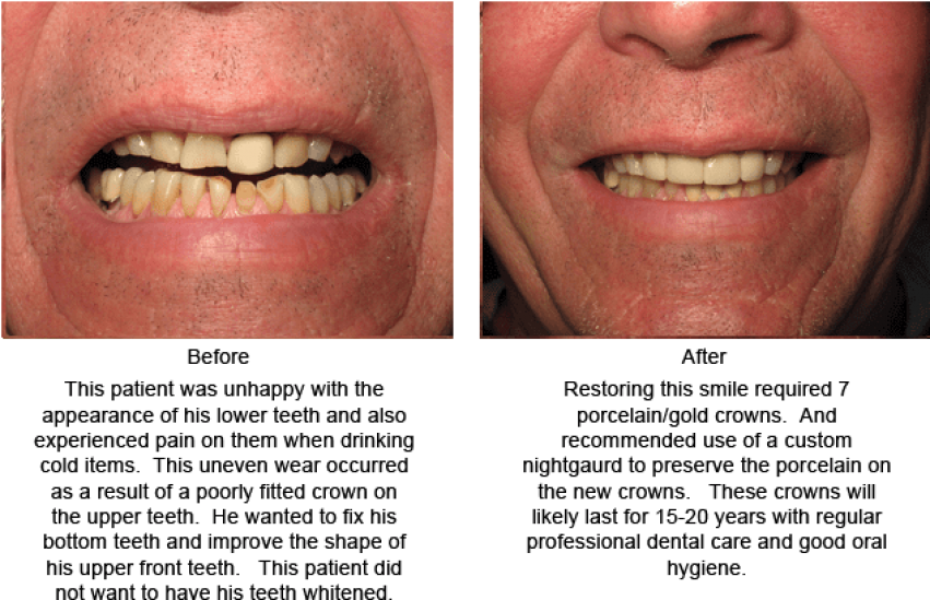 Free Png Download Aggression Png Images Background - Good Teeth Shape (851x549), Png Download