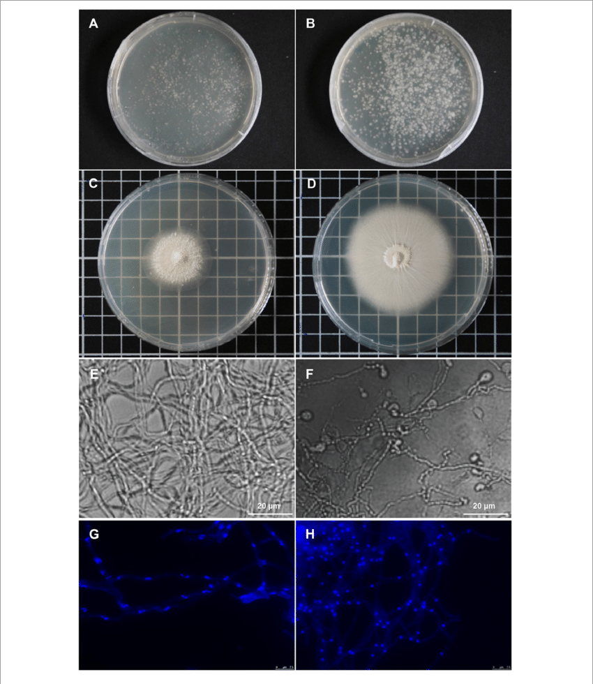 Piriformospora Indica Cultures Grown From Single Protoplasts - Laccaria Bicolor Petri Dishes (850x980), Png Download
