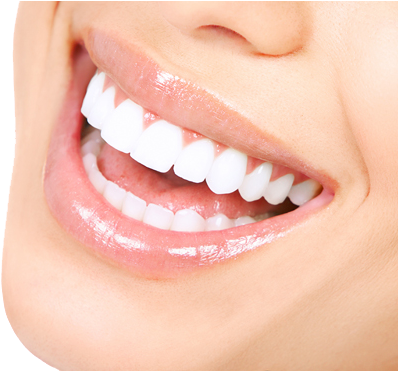 White Teeth Png Transparent Image - Crest 3d White Vivid Teeth Whitening Strips 10 Count (488x370), Png Download