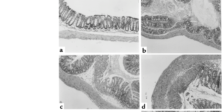 Photomicrographs Of The Proximal Colon Of Mice Treated - Monochrome (850x431), Png Download