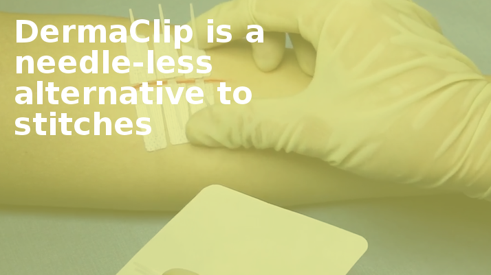 Dermaclip Is A Needle-less Alternative To Stitches - Comfort (714x401), Png Download
