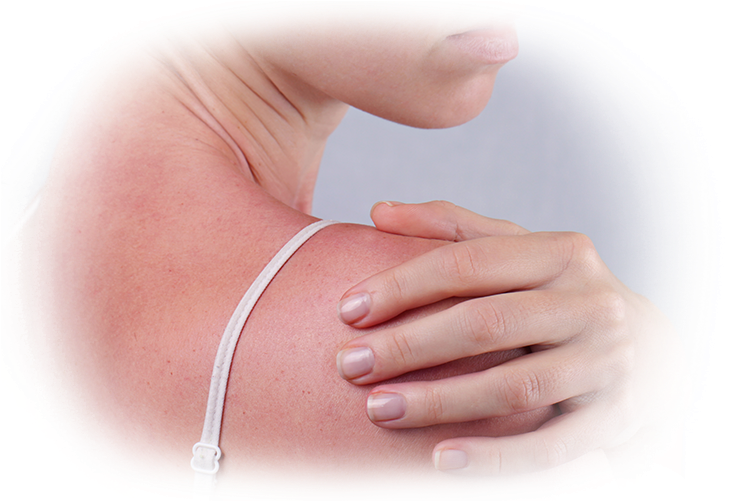 Sun Damaged Skin - Nature Republic (750x500), Png Download